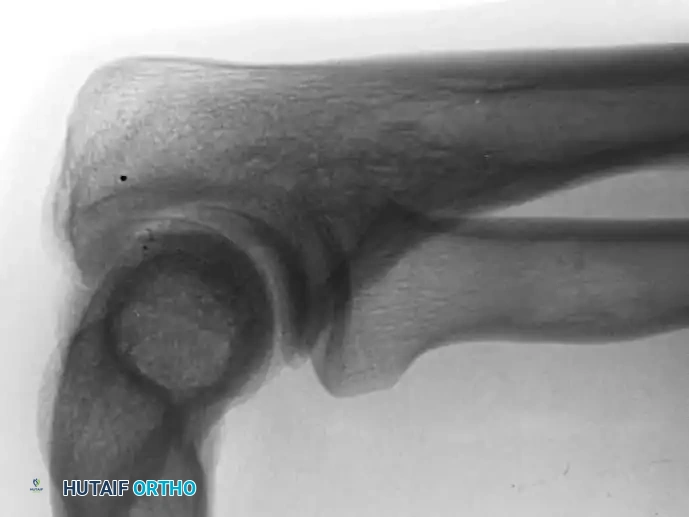 Hutaifortho's Orthopaedic Diagram