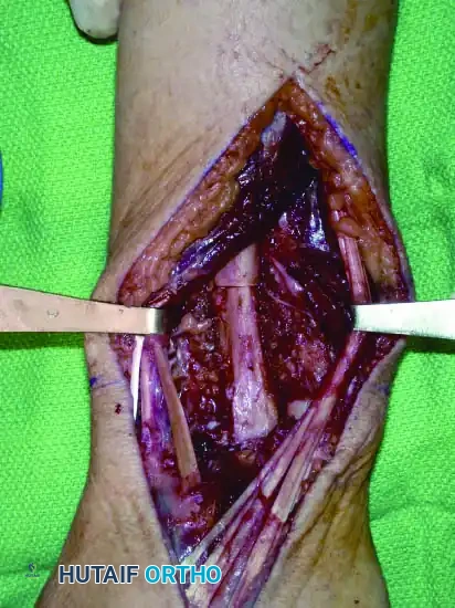 Hutaifortho's Orthopaedic Diagram
