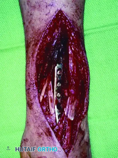 Hutaifortho's Orthopaedic Diagram