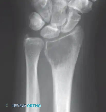 Hutaifortho's Orthopaedic Diagram