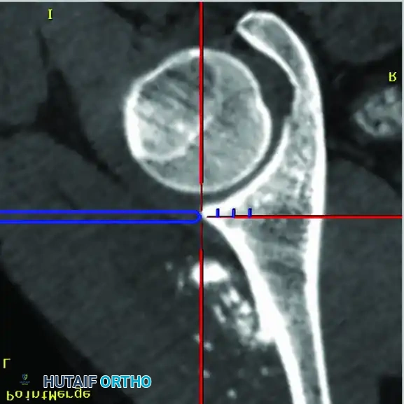 Hutaifortho's Orthopaedic Diagram