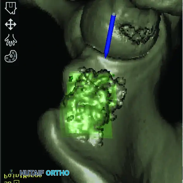Hutaifortho's Orthopaedic Diagram