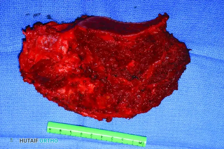 Hutaifortho's Orthopaedic Diagram