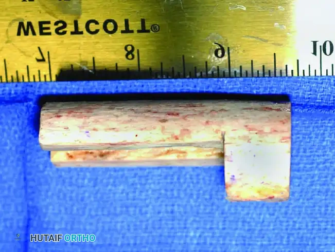 Hutaifortho's Orthopaedic Diagram
