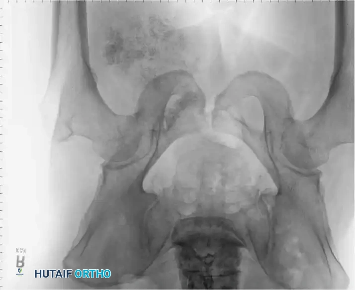 Hutaifortho's Orthopaedic Diagram