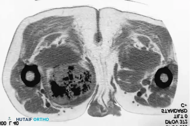 Hutaifortho's Orthopaedic Diagram