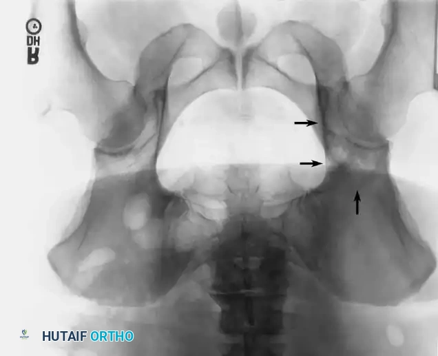 Hutaifortho's Orthopaedic Diagram