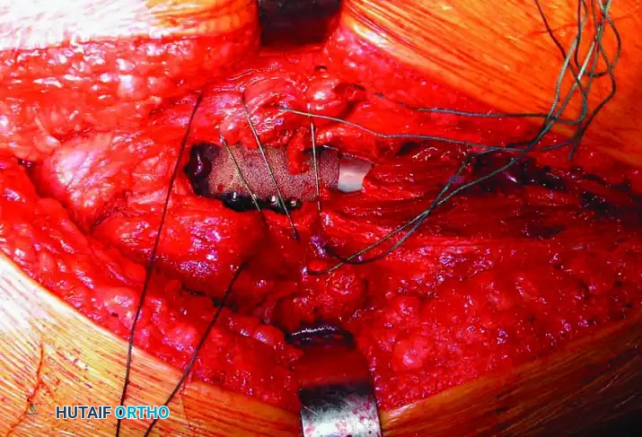 Hutaifortho's Orthopaedic Diagram