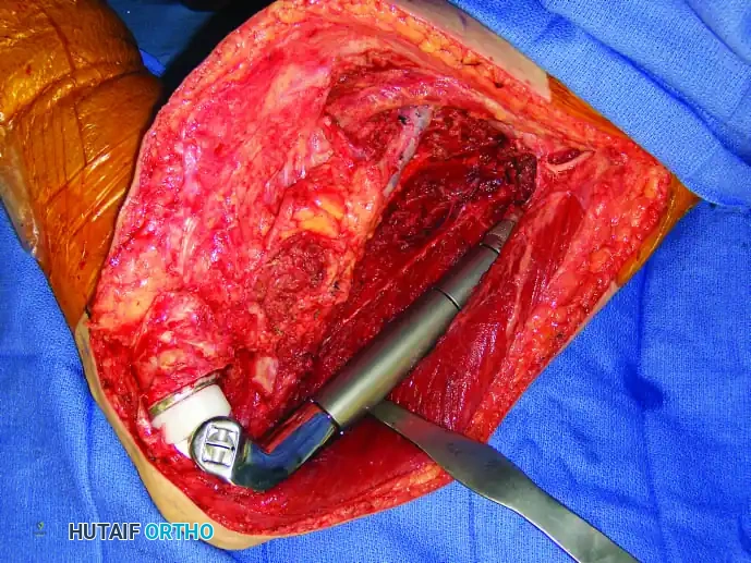 Hutaifortho's Orthopaedic Diagram