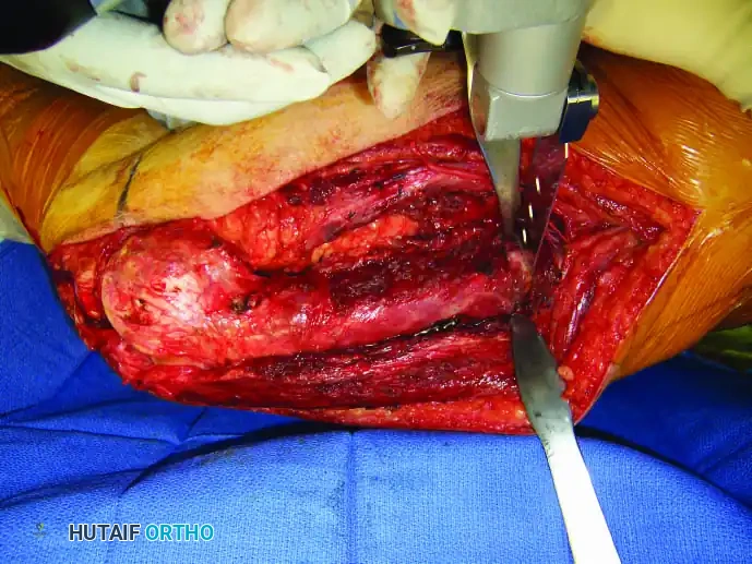 Hutaifortho's Orthopaedic Diagram