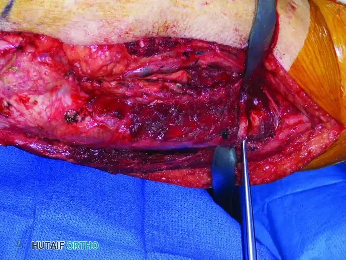 Hutaifortho's Orthopaedic Diagram