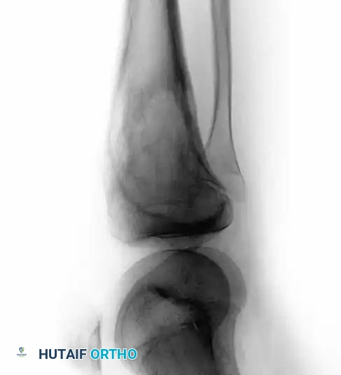 Hutaifortho's Orthopaedic Diagram