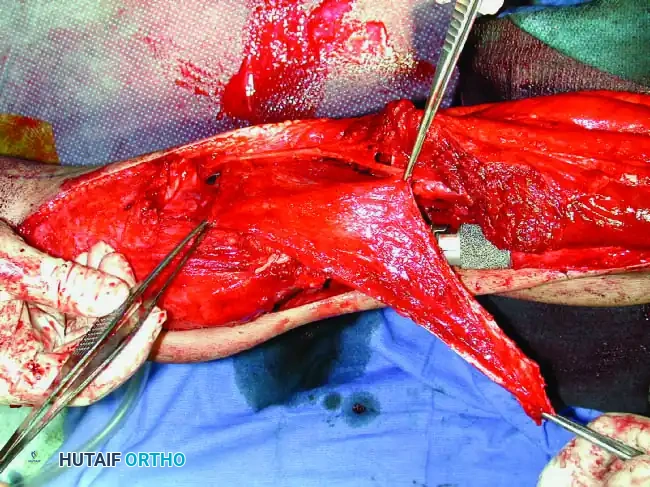 Hutaifortho's Orthopaedic Diagram