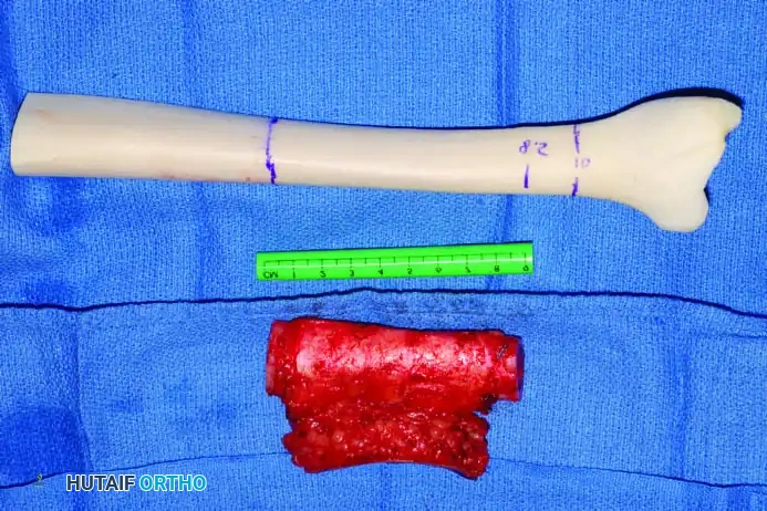 Hutaifortho's Orthopaedic Diagram