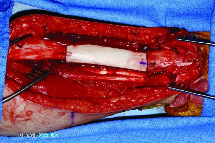 Hutaifortho's Orthopaedic Diagram