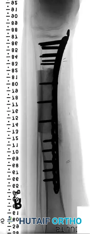 Hutaifortho's Orthopaedic Diagram