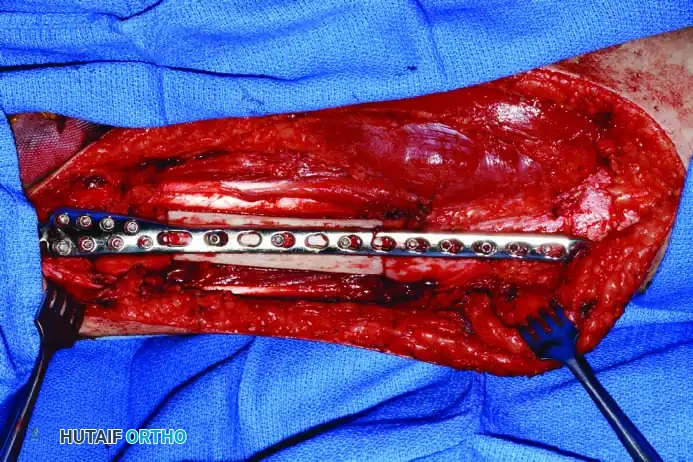 Hutaifortho's Orthopaedic Diagram