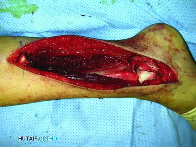 Hutaifortho's Orthopaedic Diagram