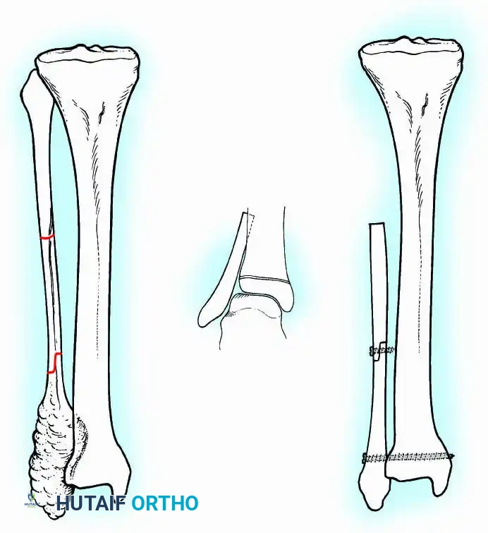 Hutaifortho's Orthopaedic Diagram