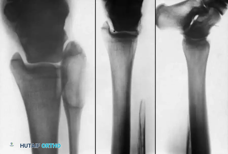 Hutaifortho's Orthopaedic Diagram