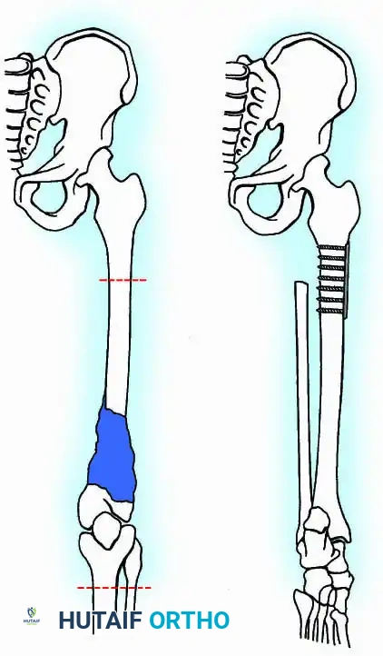 Hutaifortho's Orthopaedic Diagram
