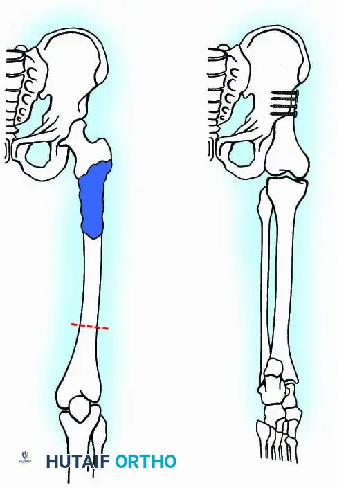 Hutaifortho's Orthopaedic Diagram