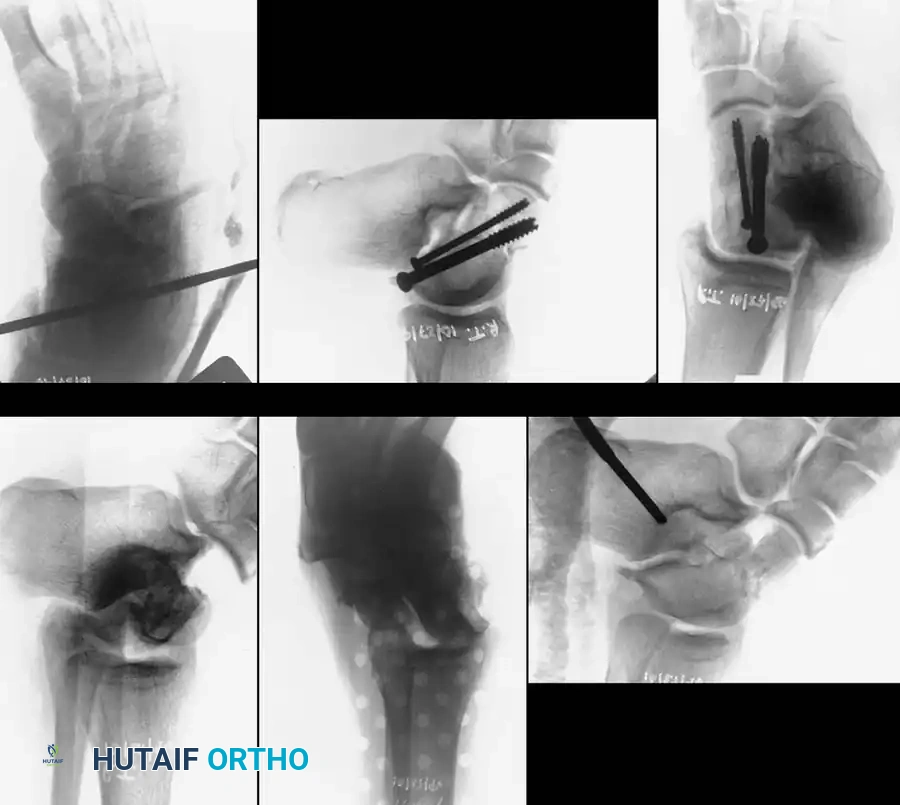Vascular anatomy diagram