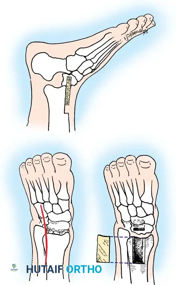 X-ray example of Canale View