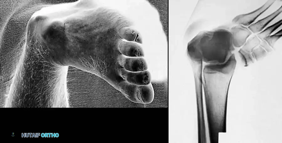 Surgical approaches diagram