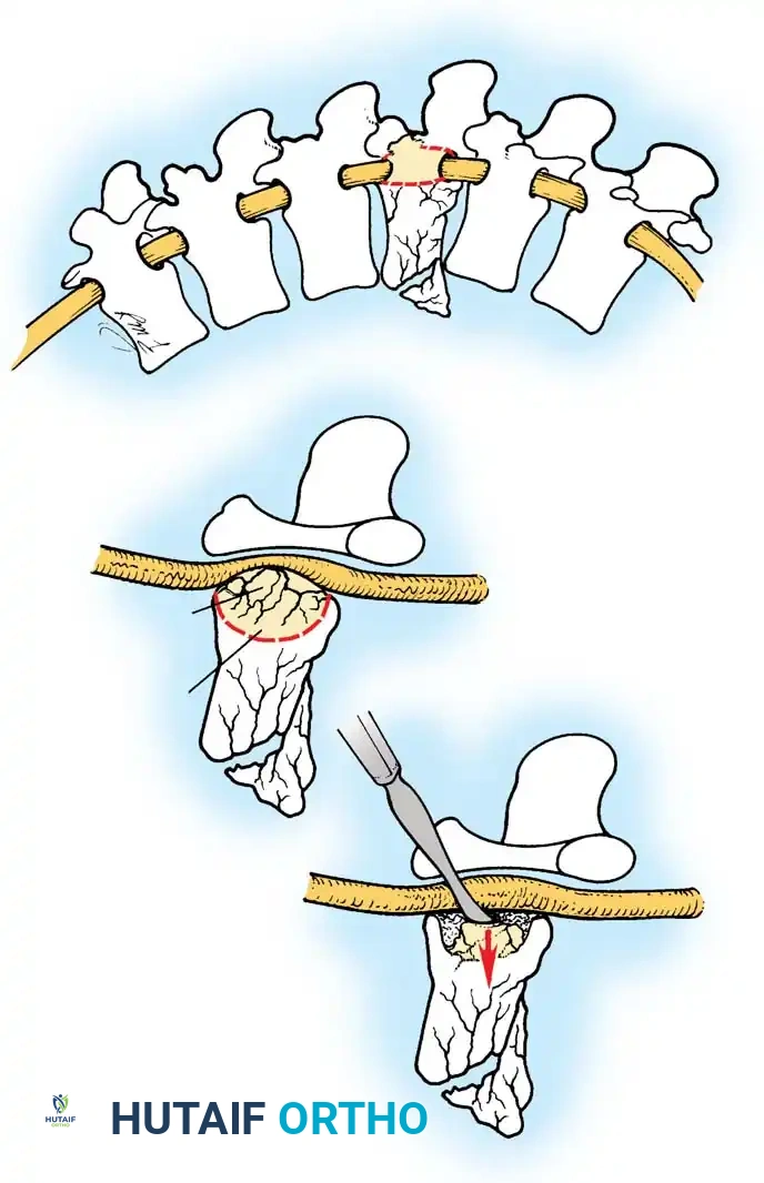 Hutaifortho's Orthopaedic Diagram