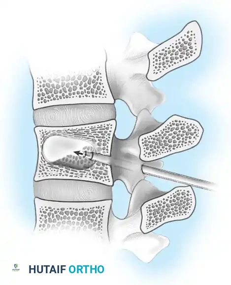 Preoperative Radiograph Example 3