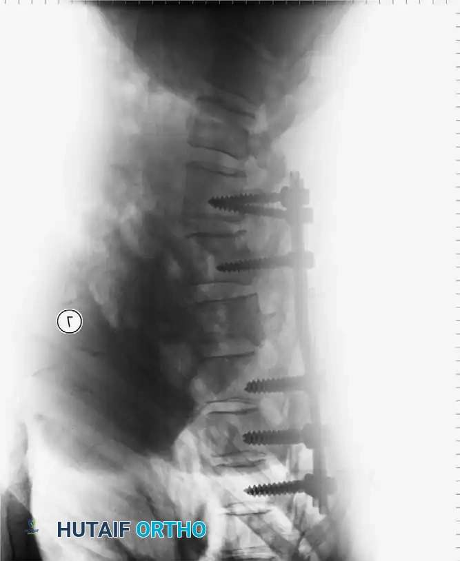Intraoperative Fluoroscopy 3