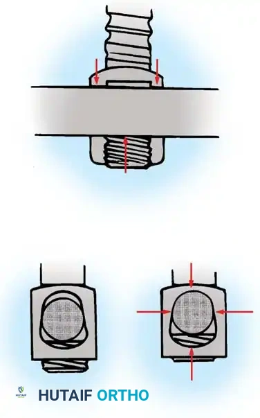 Pedicle Screw Diagram 2