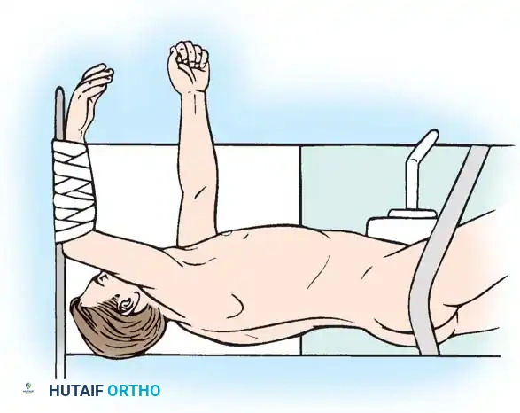 Pedicle Screw Diagram 4