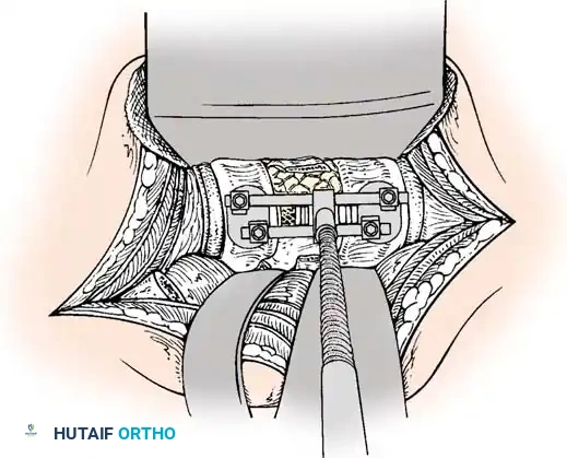 Instrumentation Diagram 6
