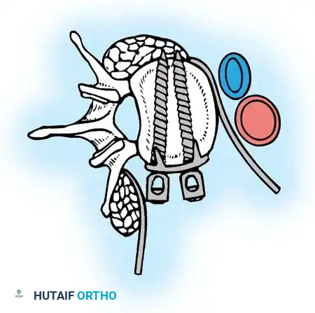 Instrumentation Diagram 1