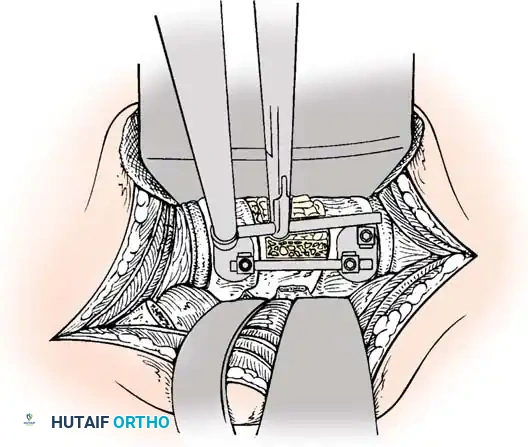 Instrumentation Diagram 5