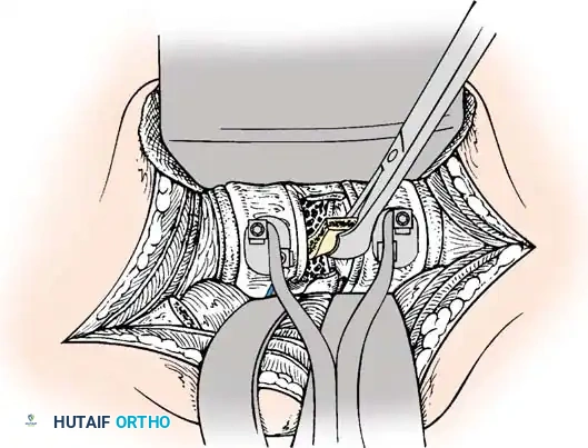 Instrumentation Diagram 7