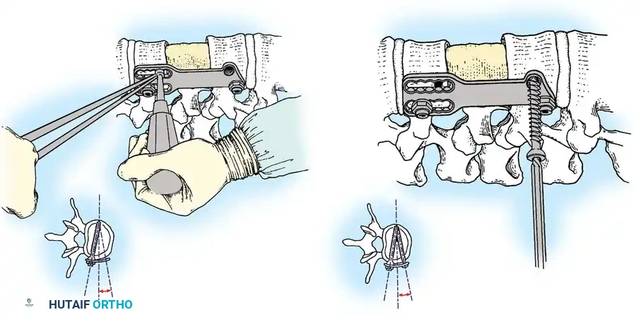 Hutaifortho's Orthopaedic Diagram