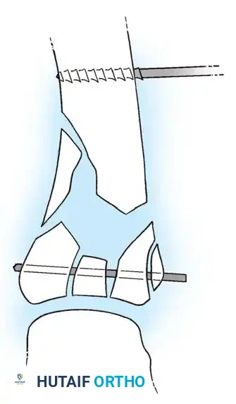 Hutaifortho's Orthopaedic Diagram