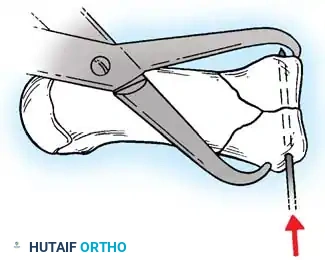 Hutaifortho's Orthopaedic Diagram