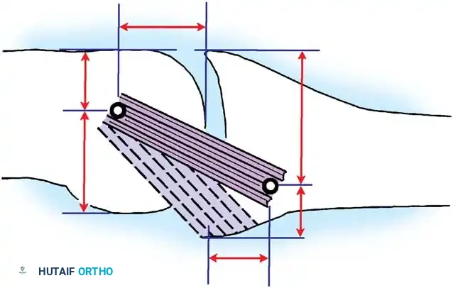 Hutaifortho's Orthopaedic Diagram