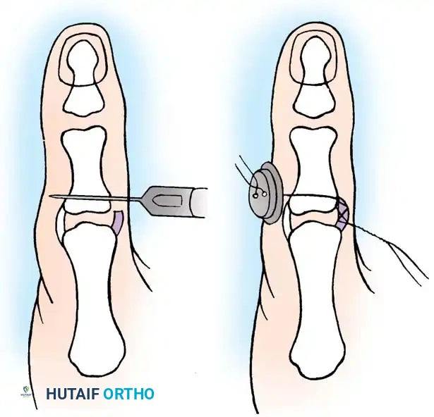 Hutaifortho's Orthopaedic Diagram