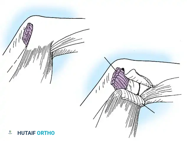 Hutaifortho's Orthopaedic Diagram