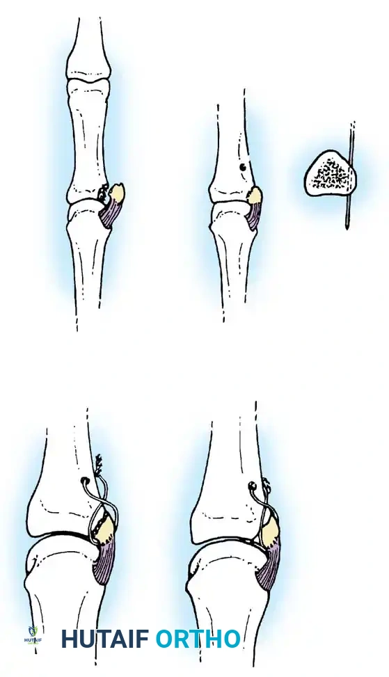 Hutaifortho's Orthopaedic Diagram