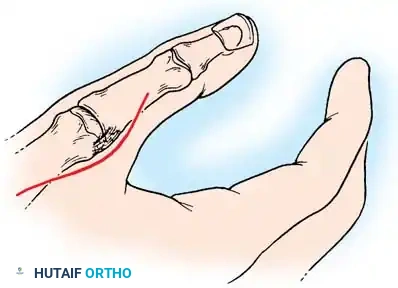 Hutaifortho's Orthopaedic Diagram