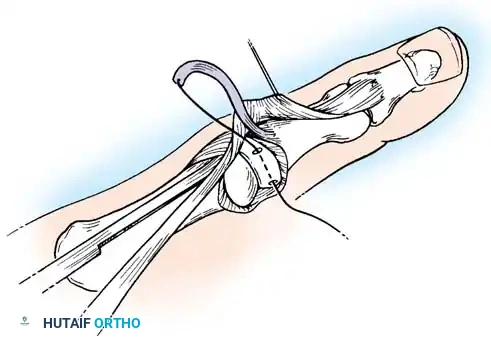 Hutaifortho's Orthopaedic Diagram