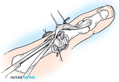 Hutaifortho's Orthopaedic Diagram