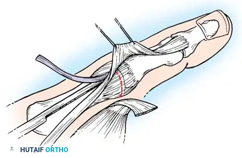 Hutaifortho's Orthopaedic Diagram