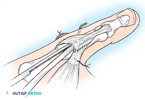 Hutaifortho's Orthopaedic Diagram